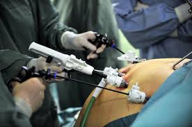 by pass à marseille